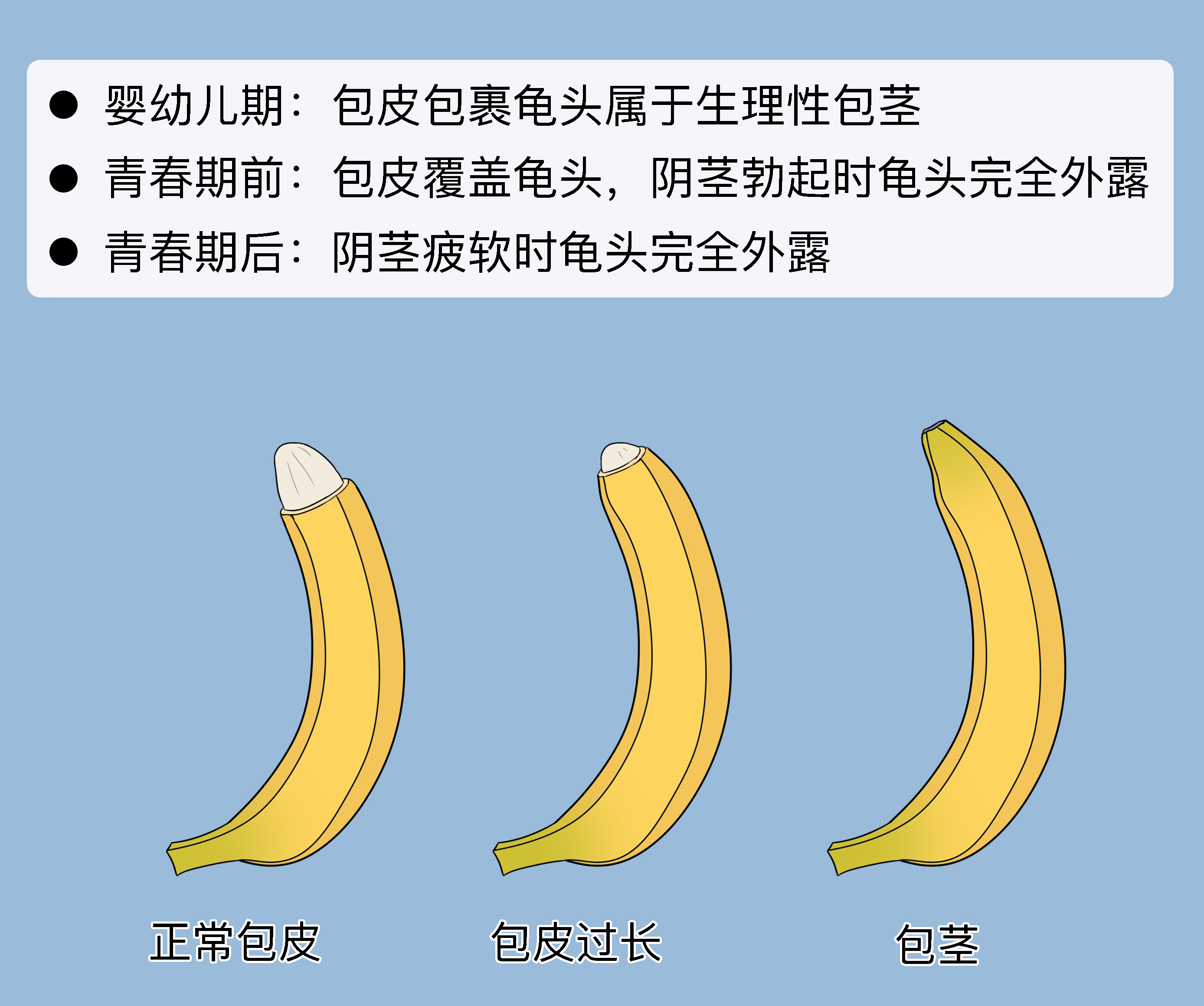 男人的包皮是怎样的图片