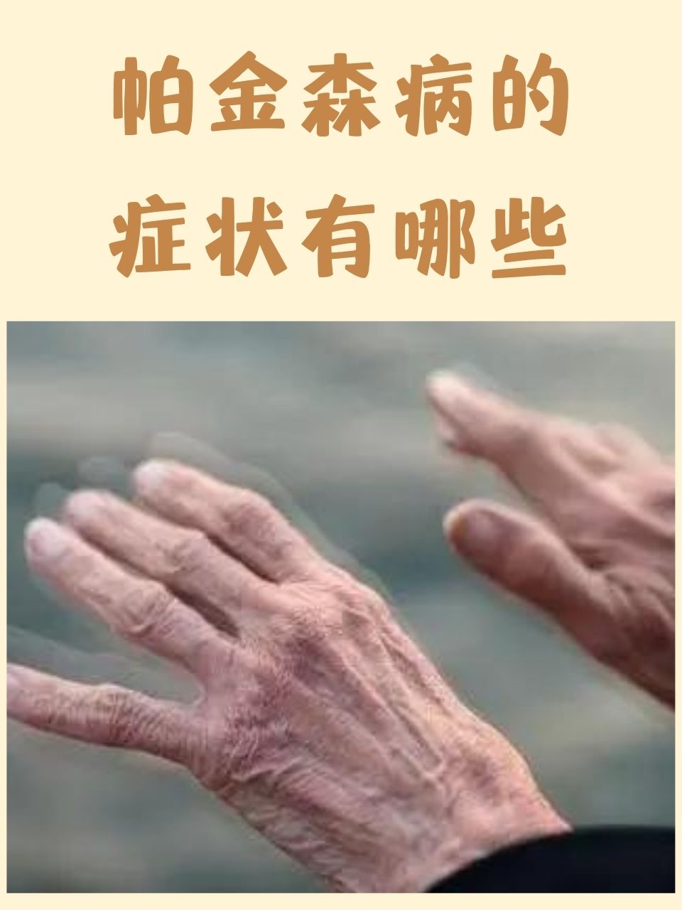 帕金森病是怎么得上的