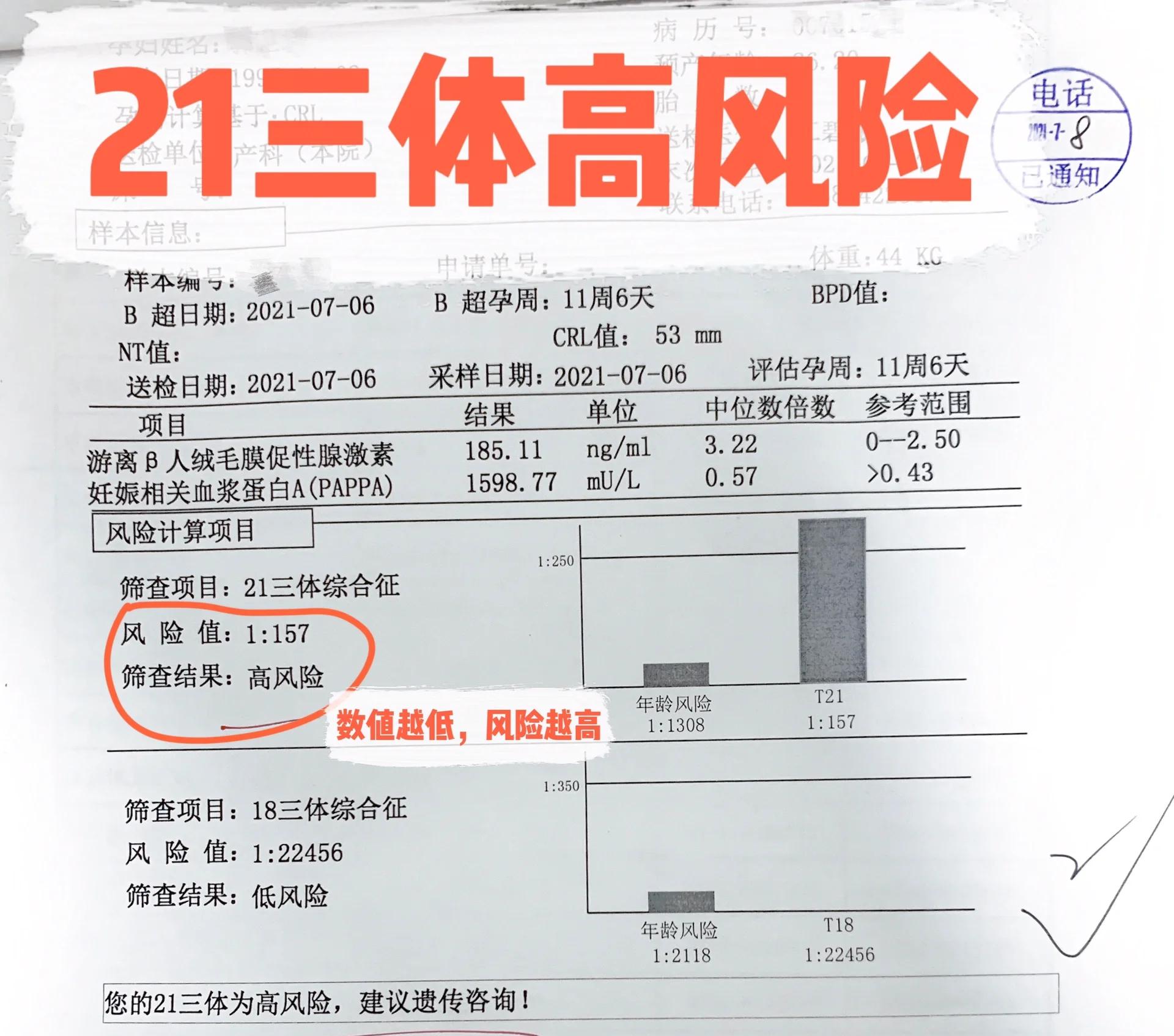 唐筛高风险怎么办