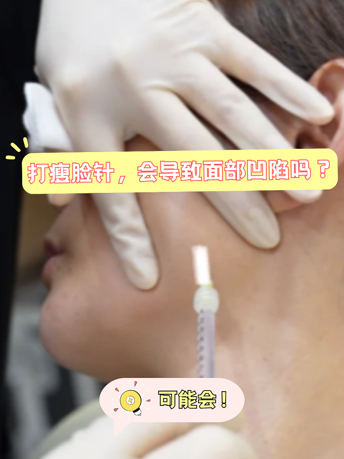 打完瘦脸针注意事项