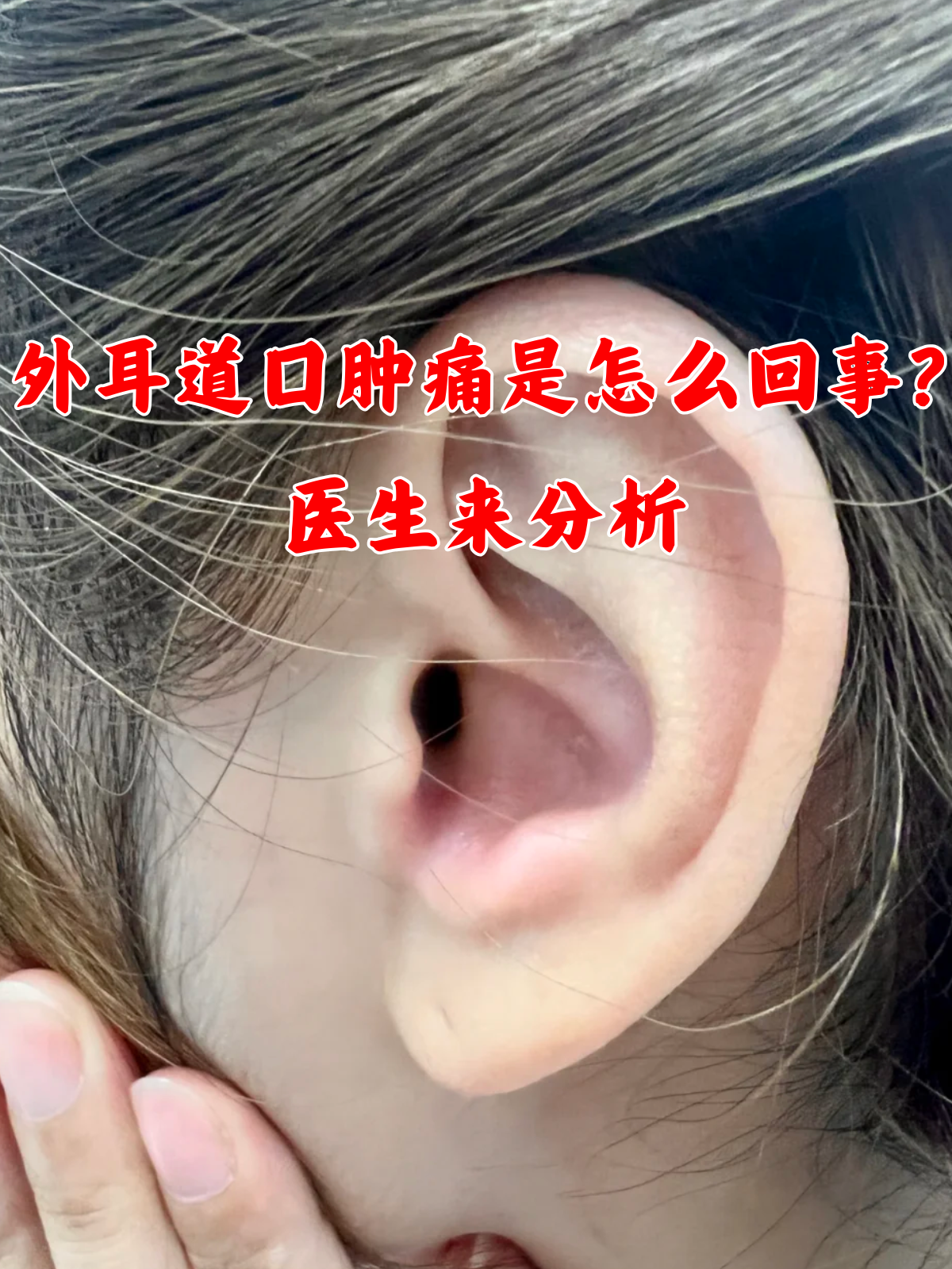 耳朵里面疼是怎么回事?