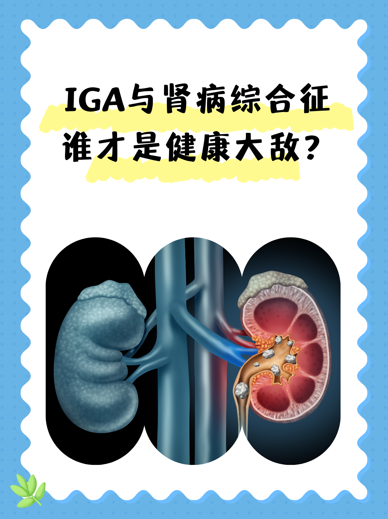 原发性肾病综合征是什么病