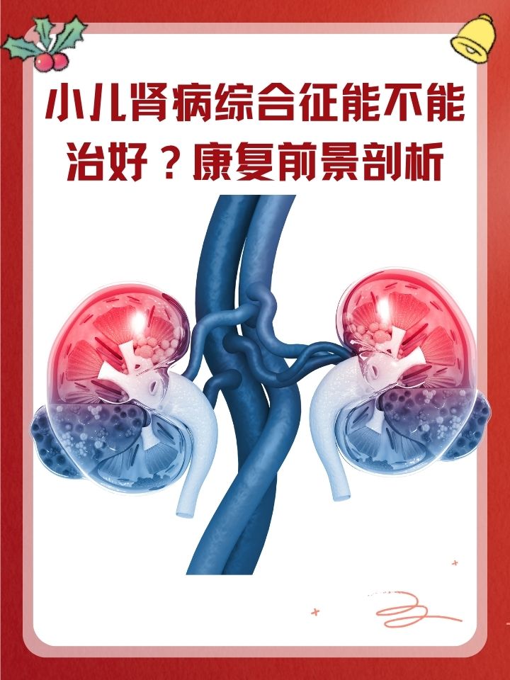 原发性肾病综合征是什么病