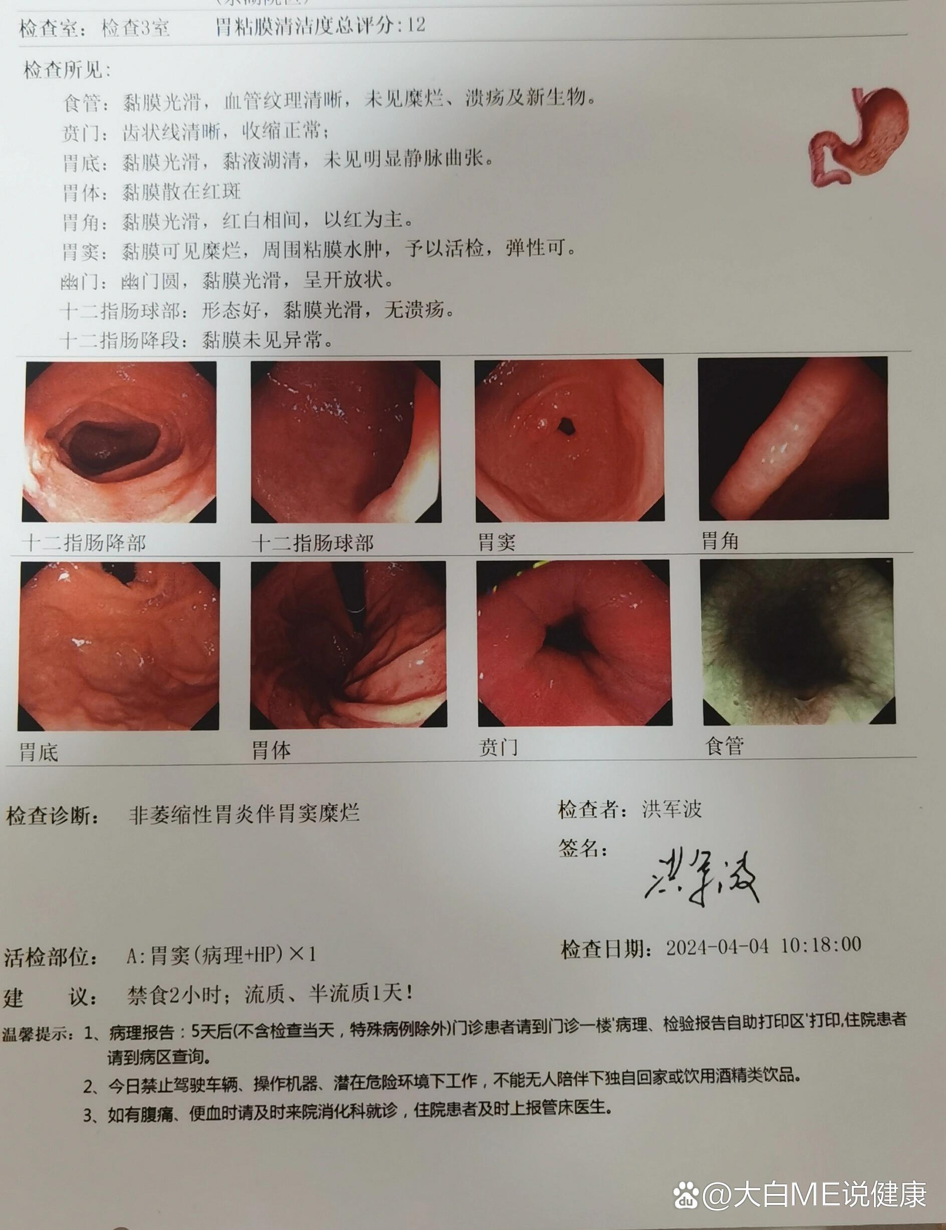 急性胃粘膜病变的表现有哪些