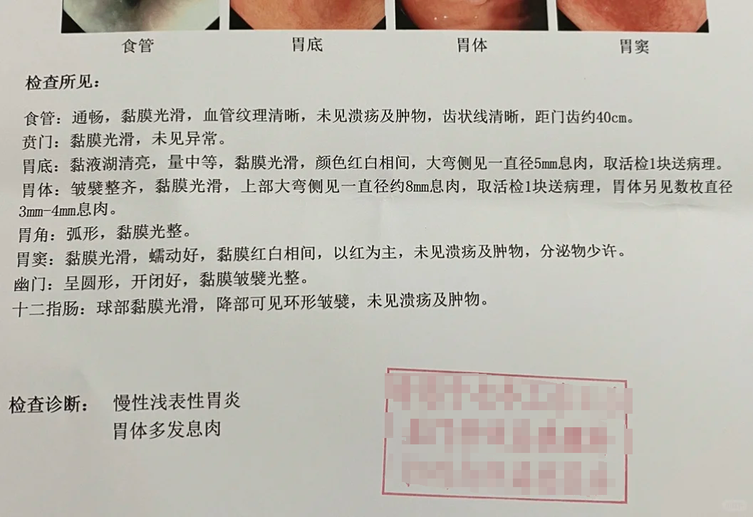 急性胃粘膜病变的表现有哪些