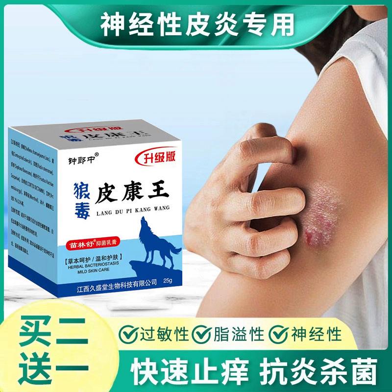 紫外线过敏擦什么药