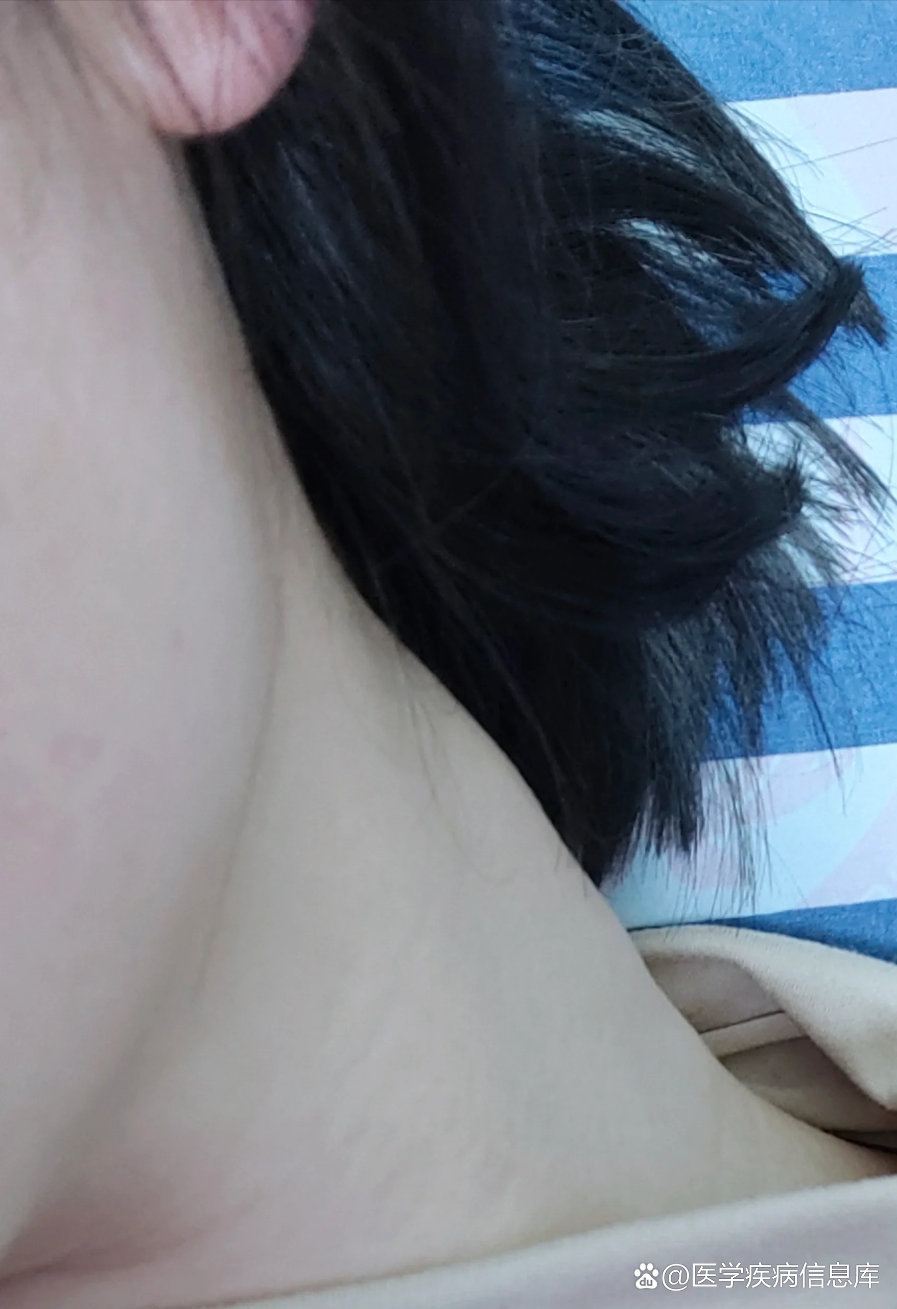 颈部淋巴结长期肿大,危险吗