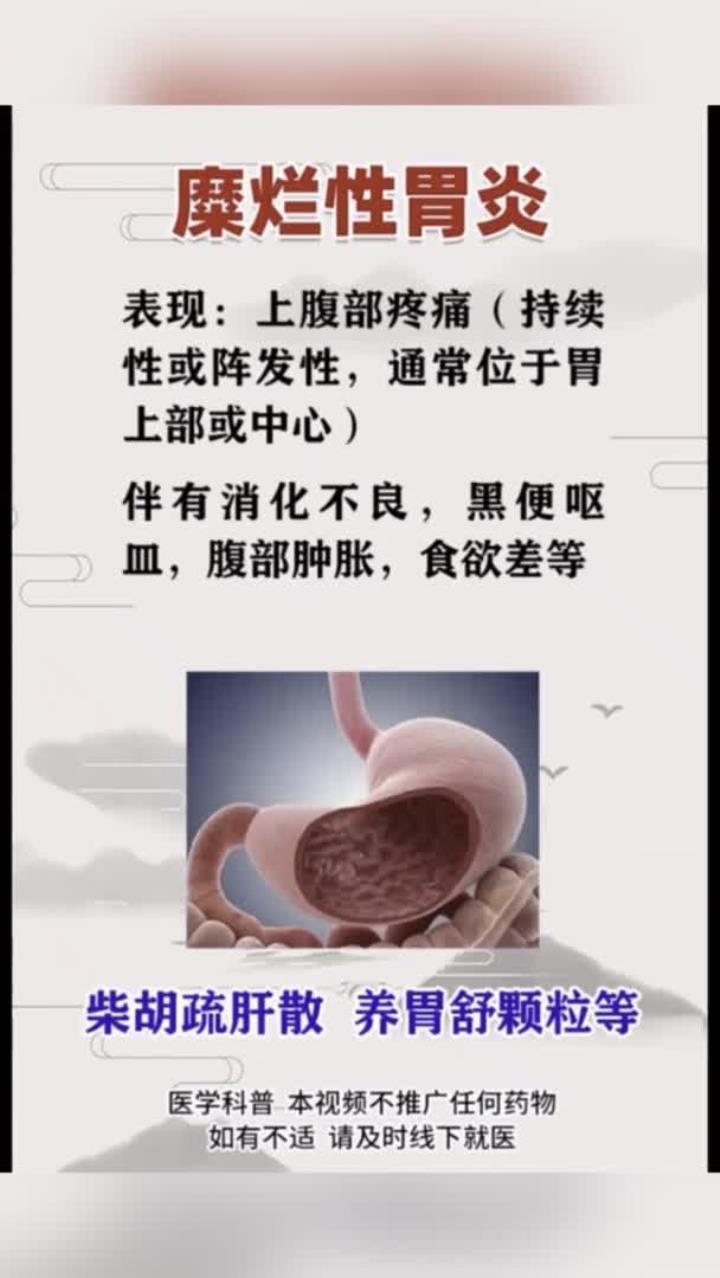 浅表萎缩性胃炎严重吗