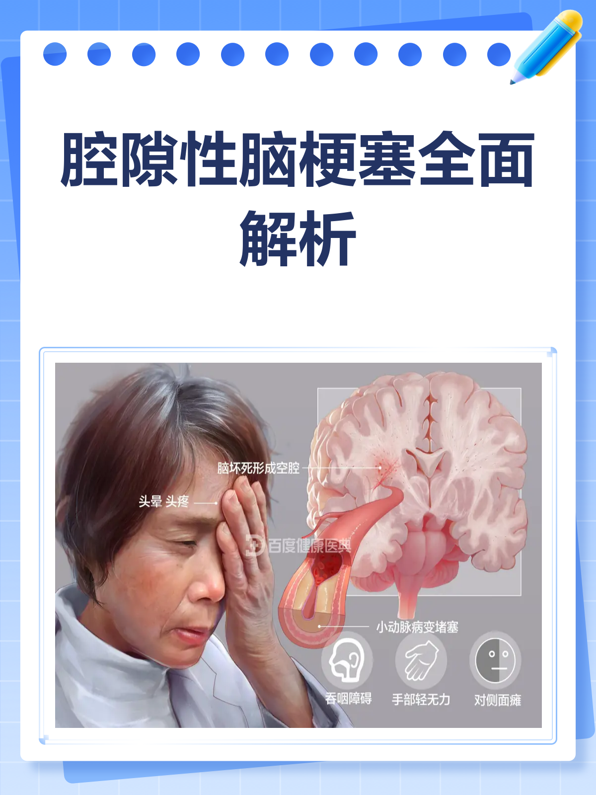 多发腔隙性脑梗塞严重吗