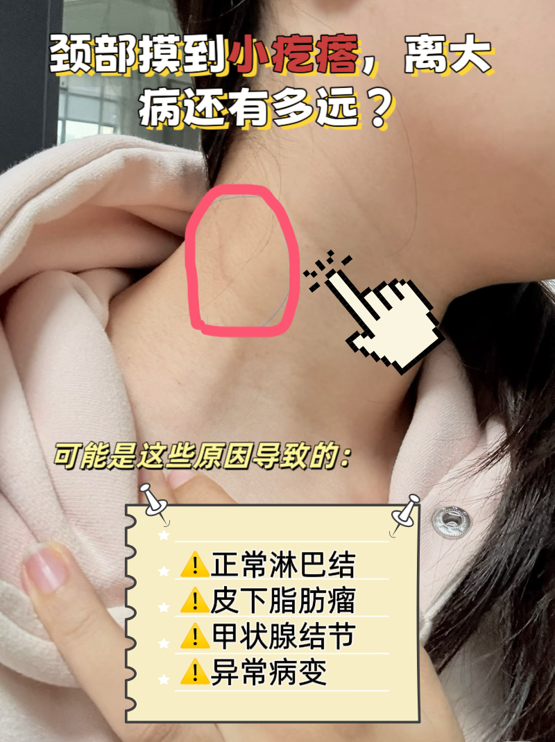 淋巴结发炎是什么症状