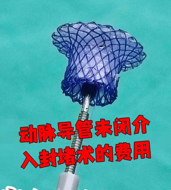 介入治疗的费用是多少