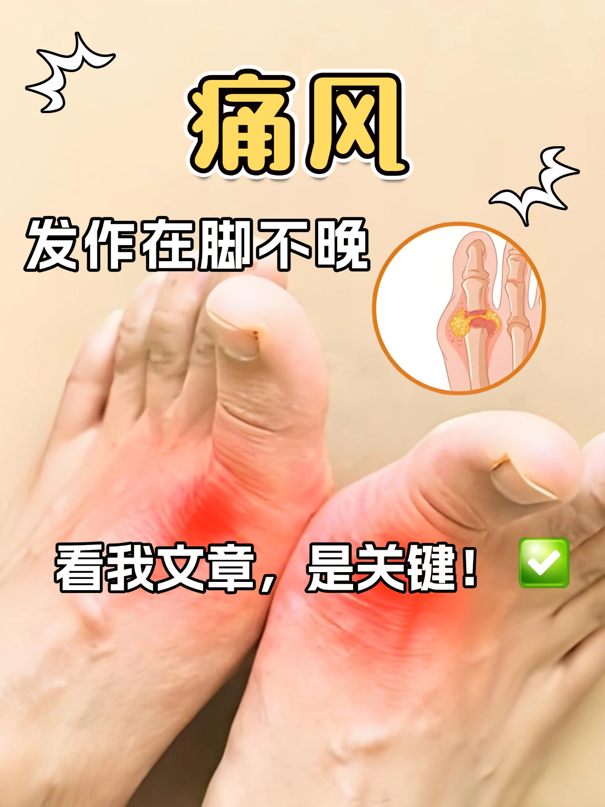 脚痛风的症状是什么