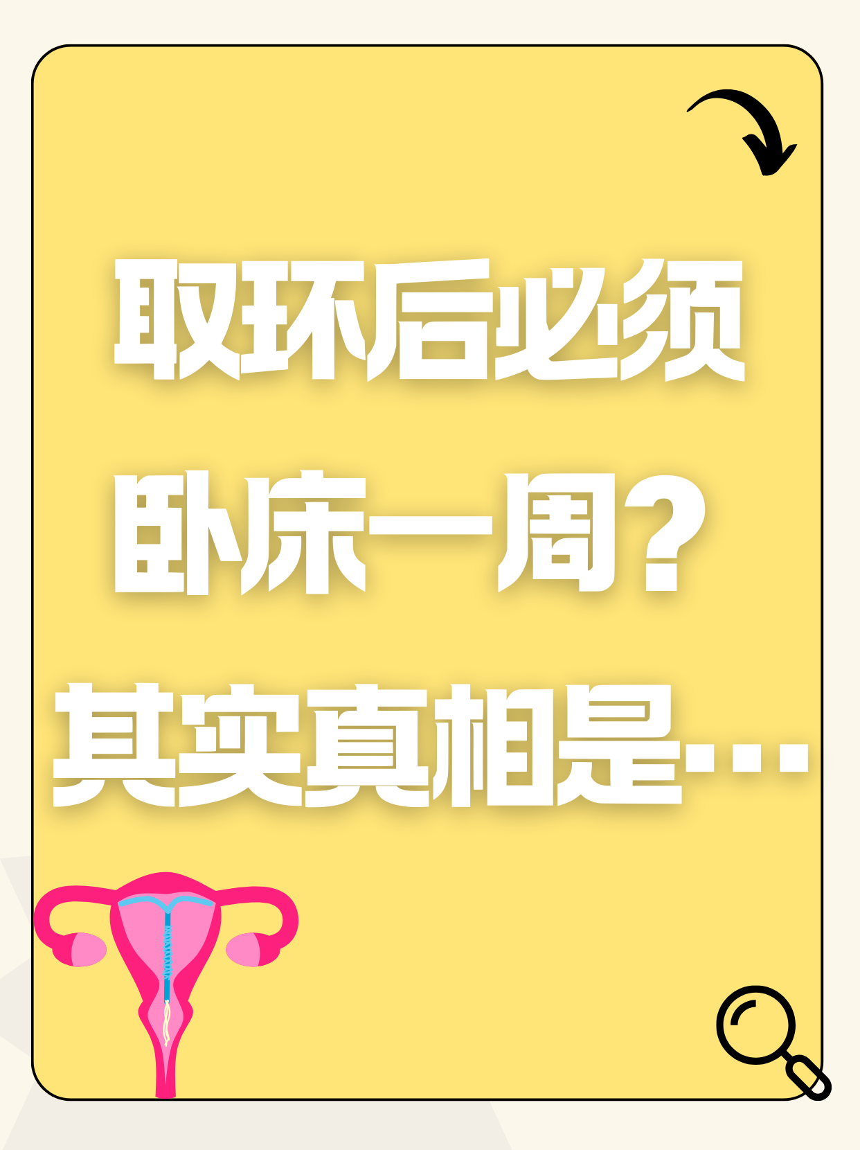 什么时候上环最合适