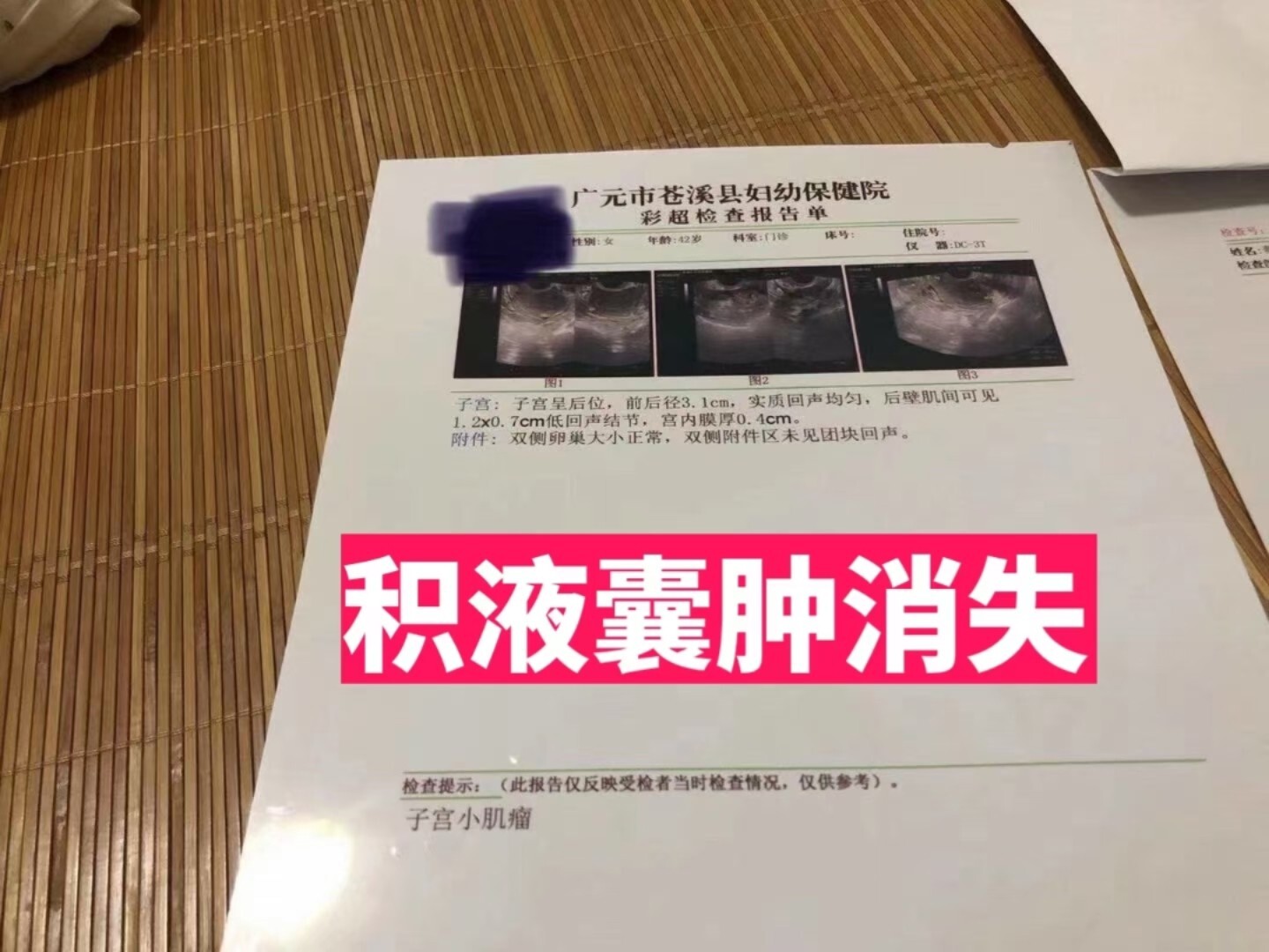 宫颈囊肿吃药能消失吗