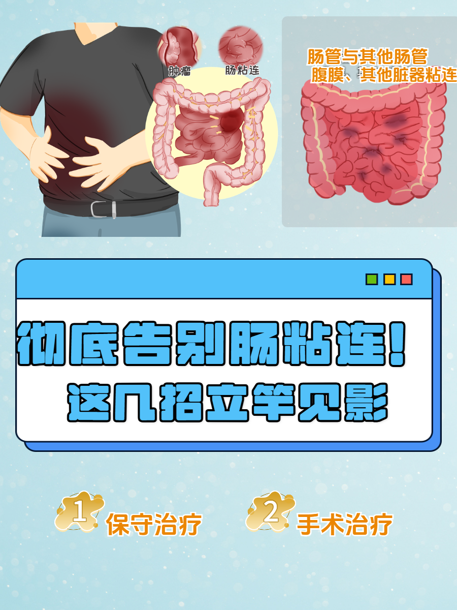 肠粘连的症状有哪些