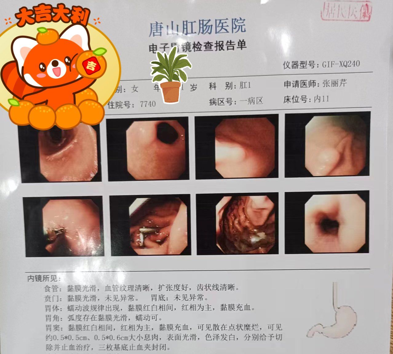 胃镜和肠镜可以一起做了吗