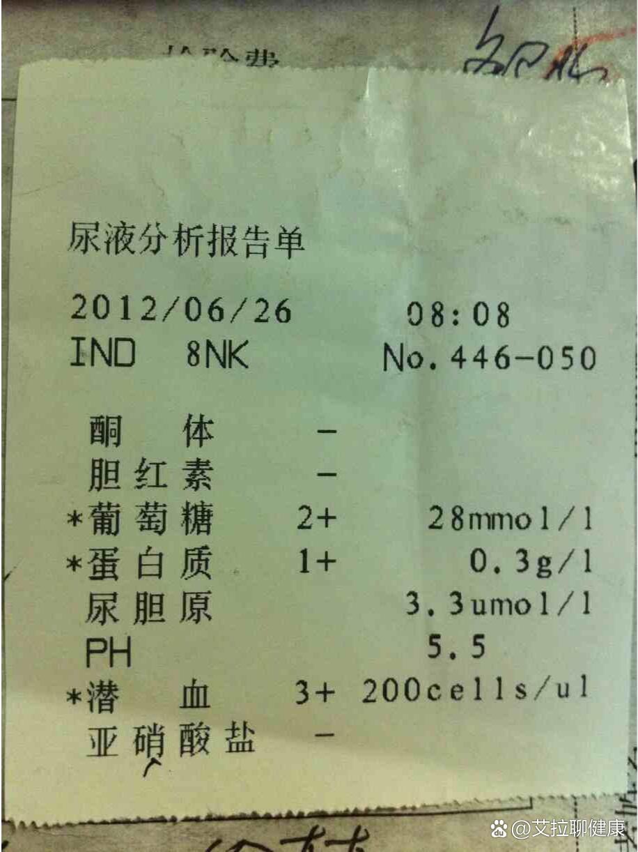 选择性蛋白尿是怎样的