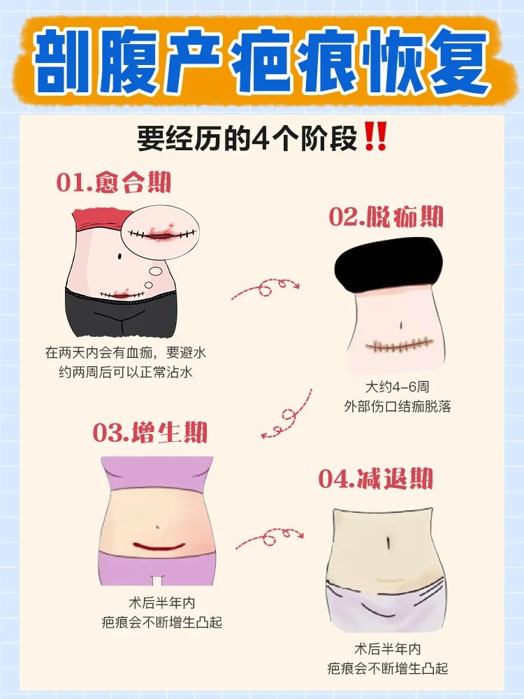 剖腹产不排气怎么办