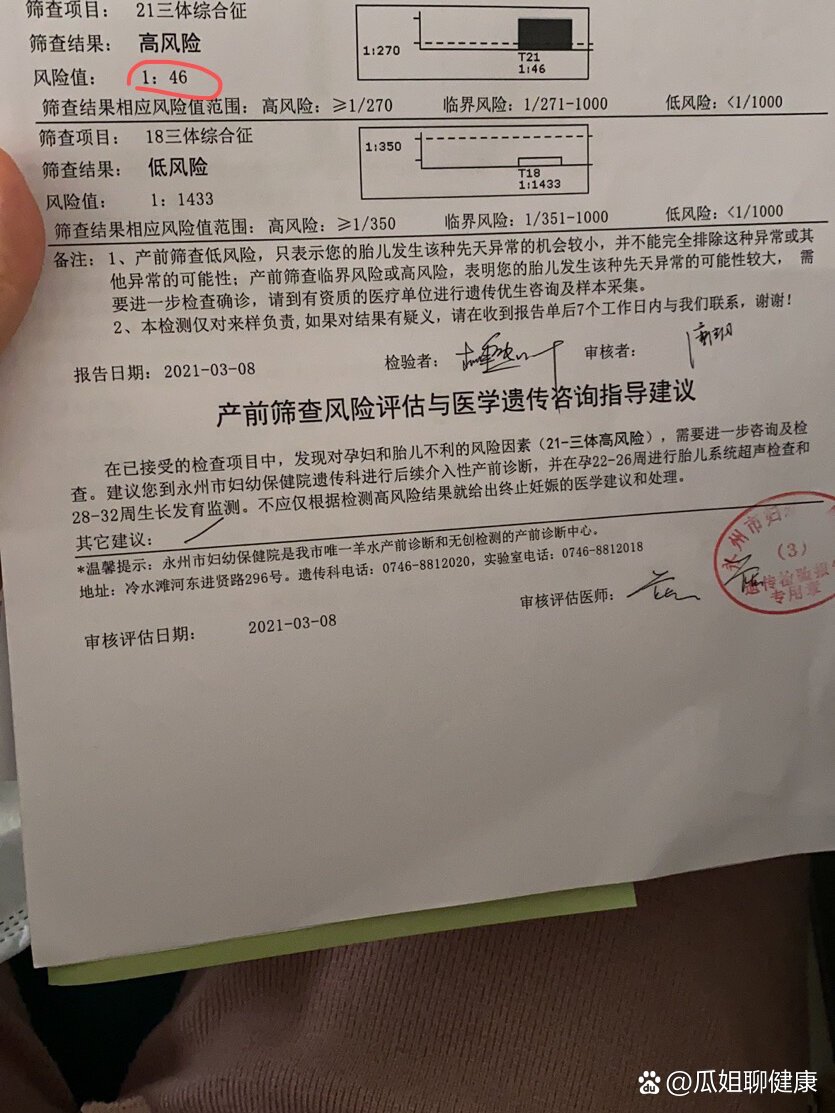 21三体综合征的临界风险是什么