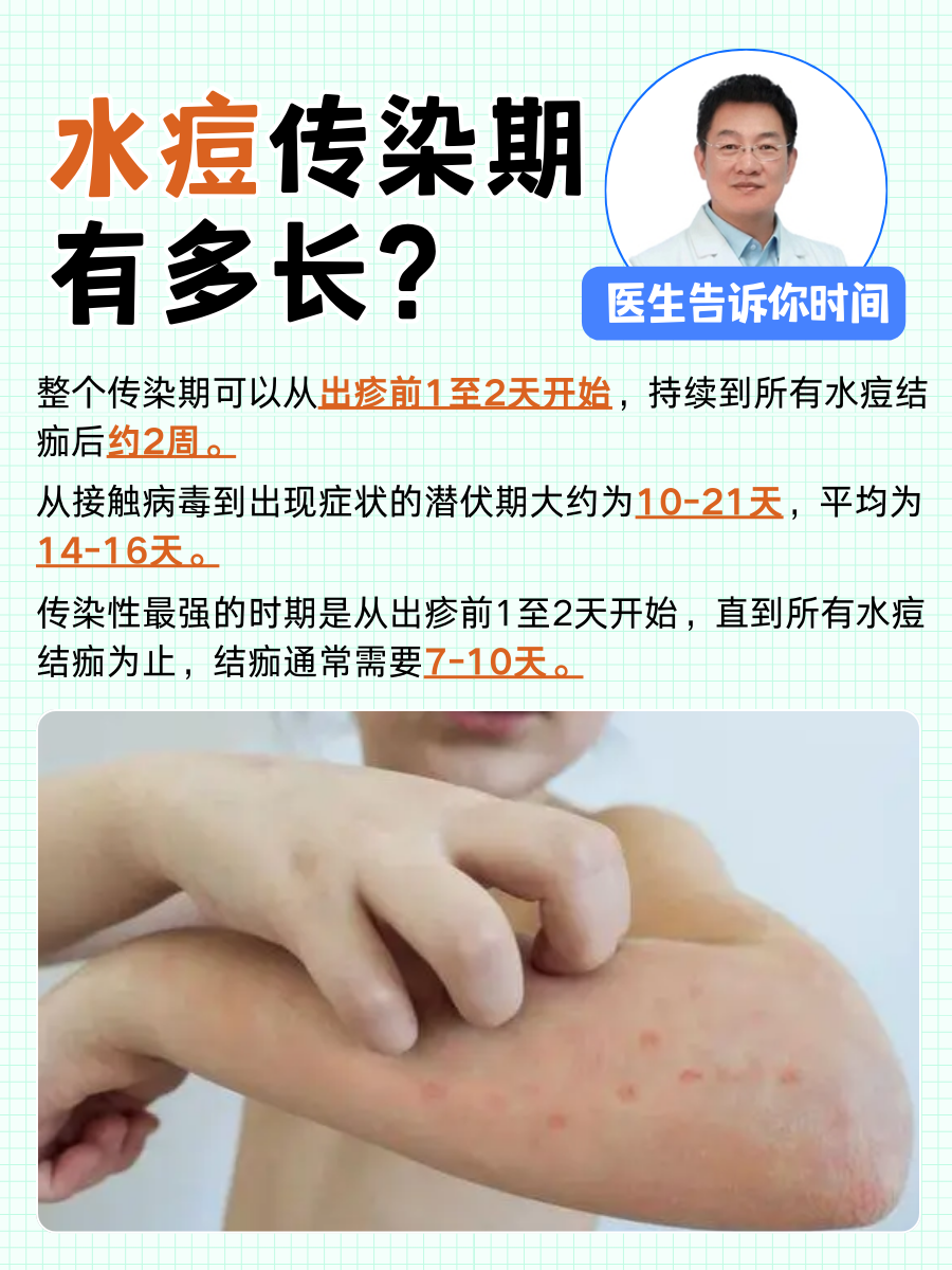 长水痘怎么治疗