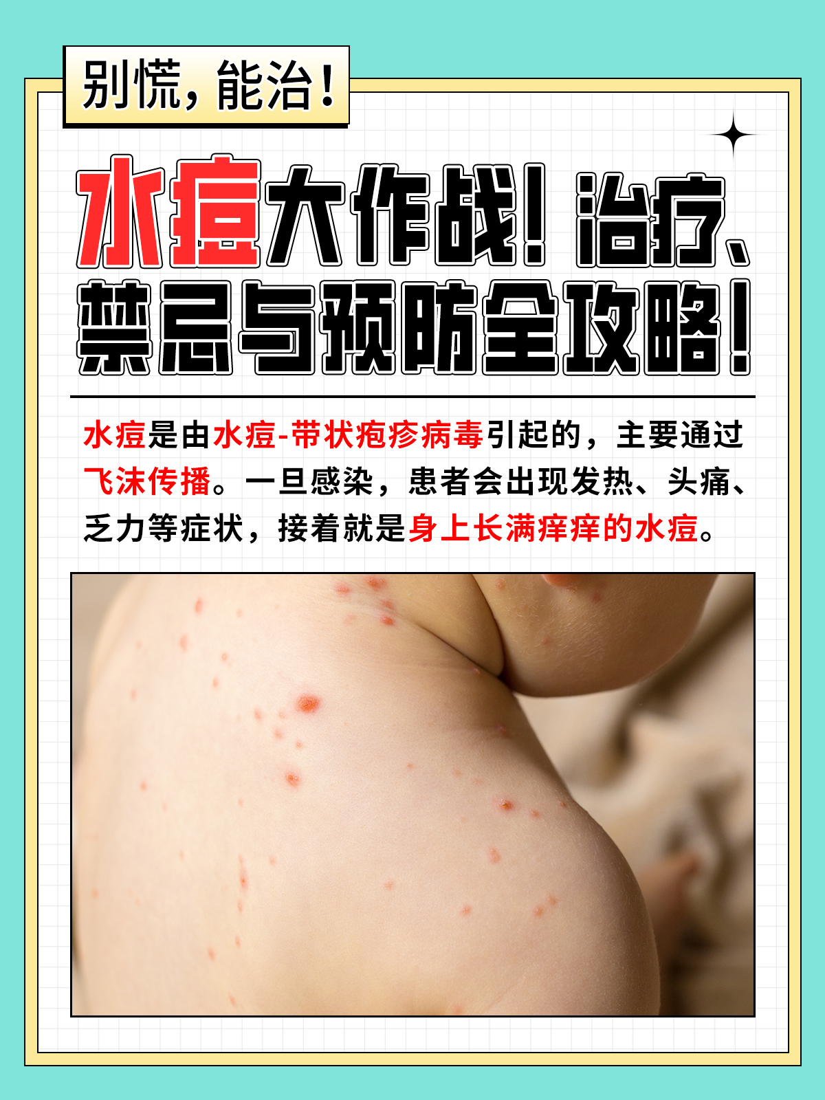 长水痘怎么治疗