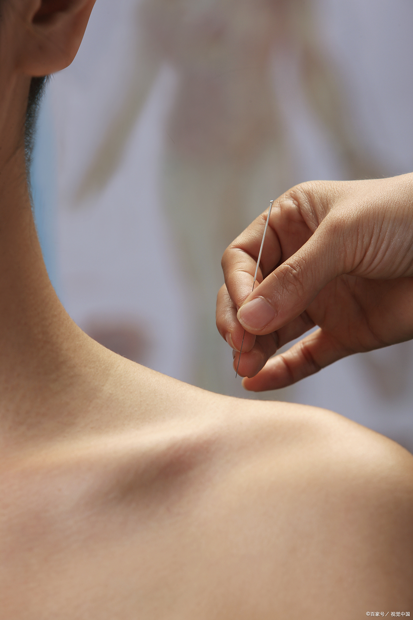 肩袖损伤保守治疗方法