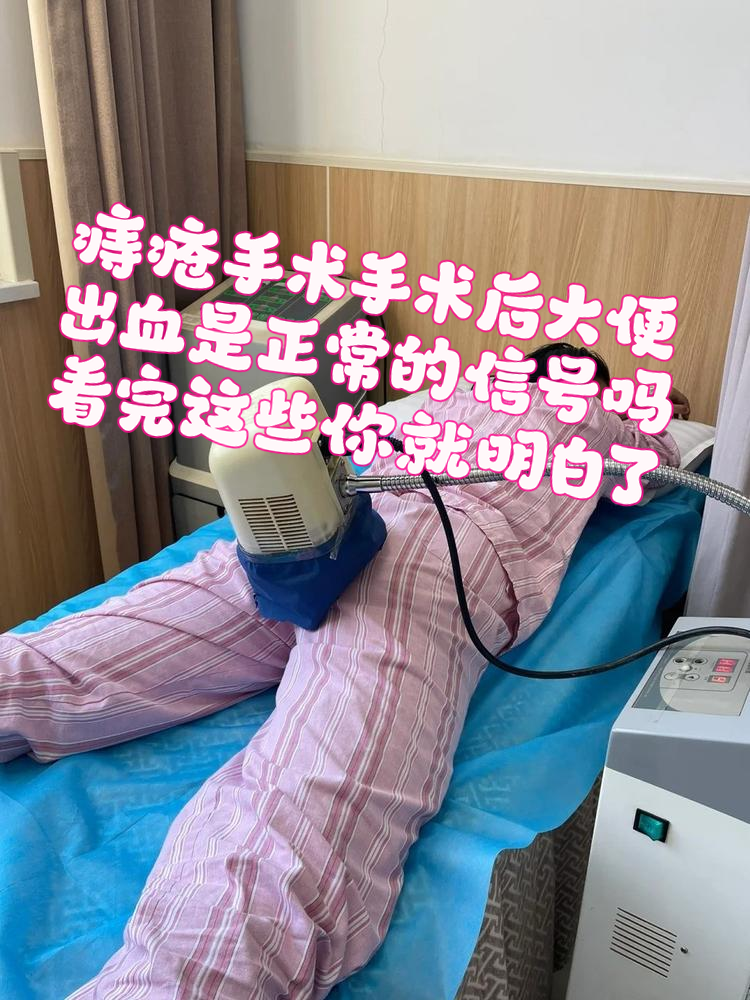 痔疮一定要做手术吗