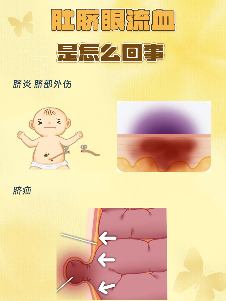 脐带血穿刺能查出什么