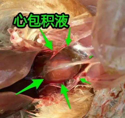 心包积液严重吗