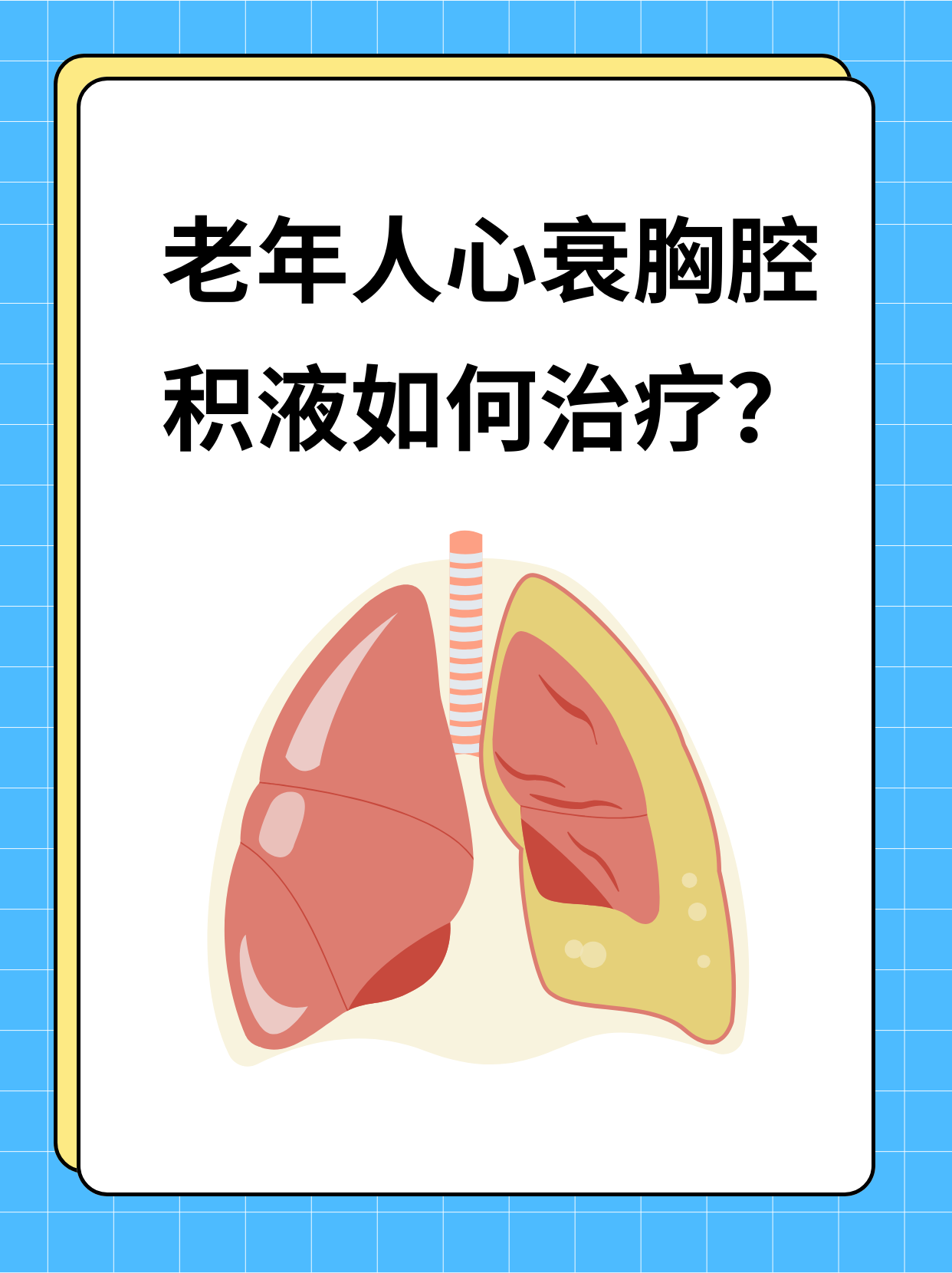 心包积液严重吗