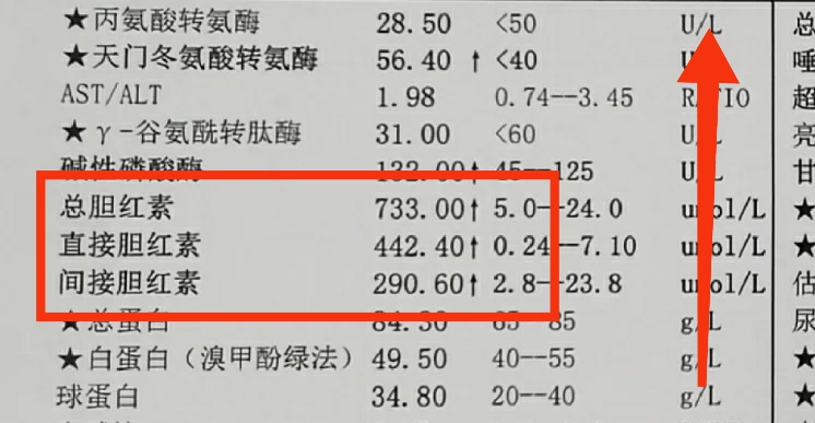 总胆红素偏高有什么危害