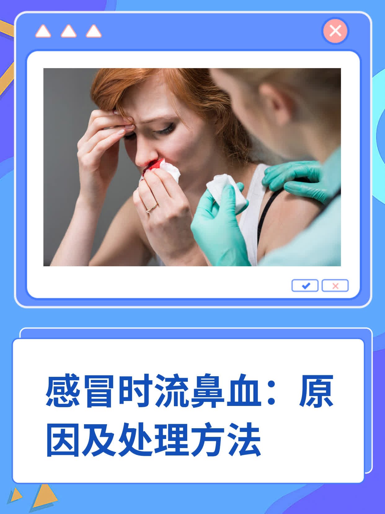 流鼻血止不住怎么办