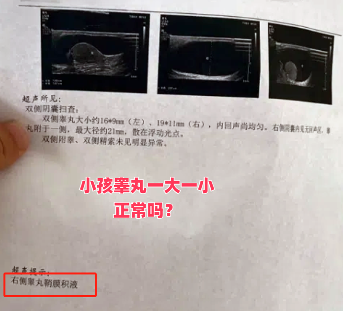 睾丸大小有标准吗?