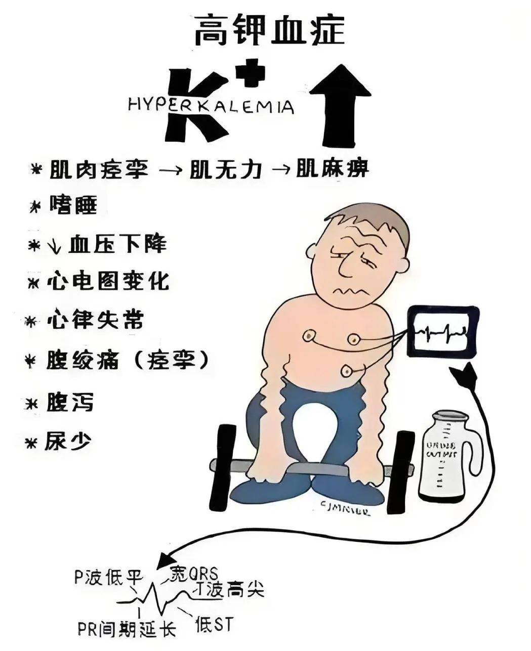 高钾血症处理方法