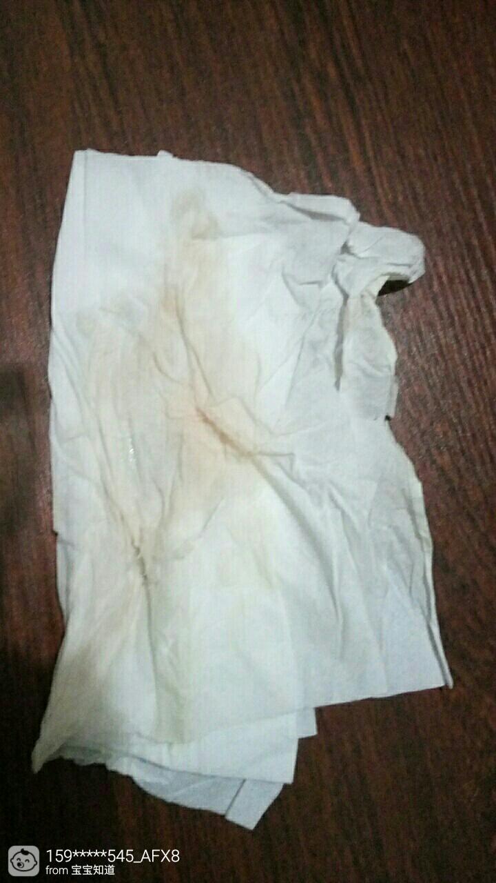 破水了肚子不痛什么时候生