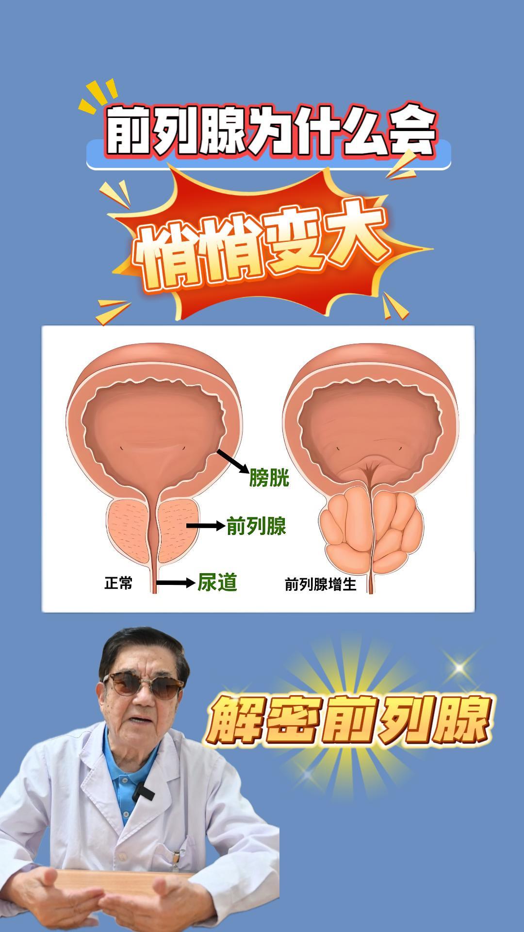 前列腺肥大的症状有几种