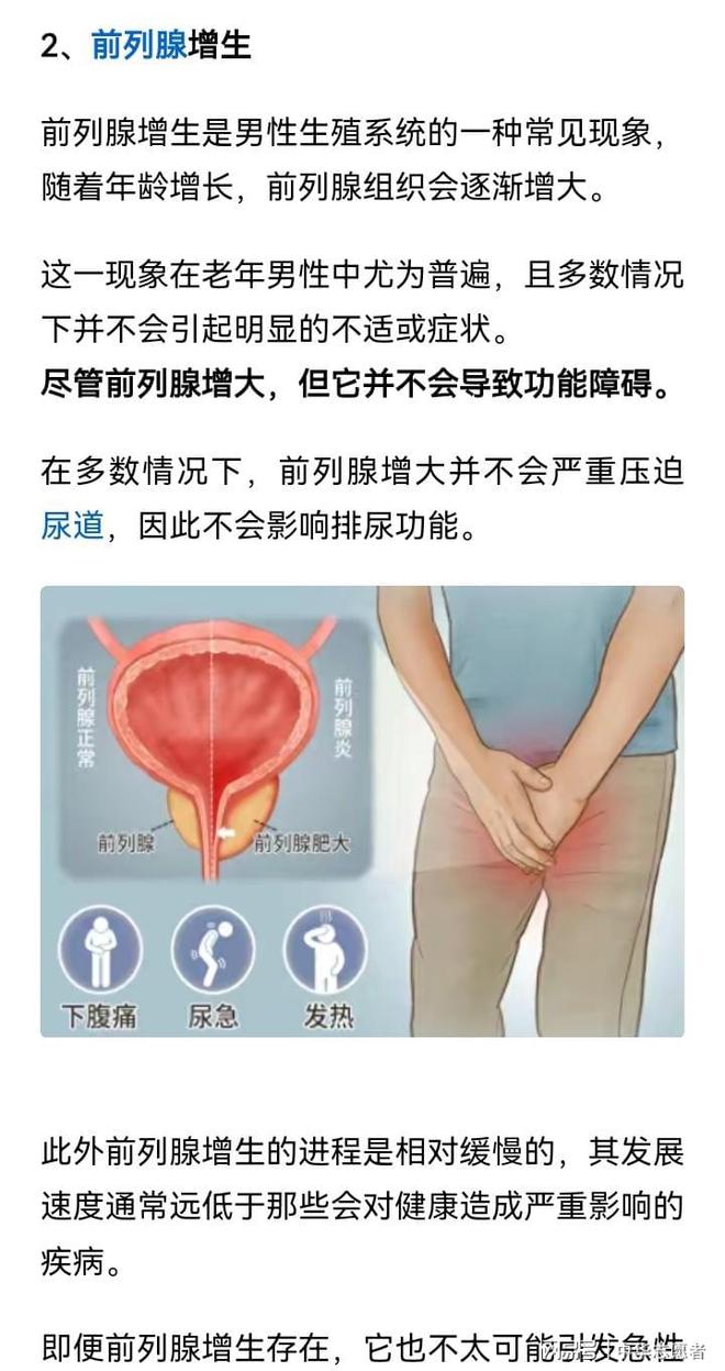 前列腺肥大的症状有几种