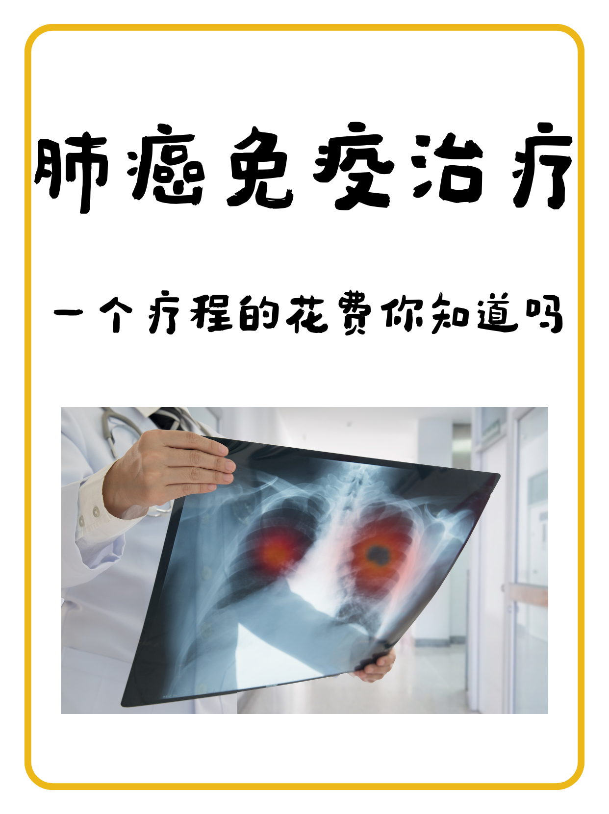 怎么检查肺癌