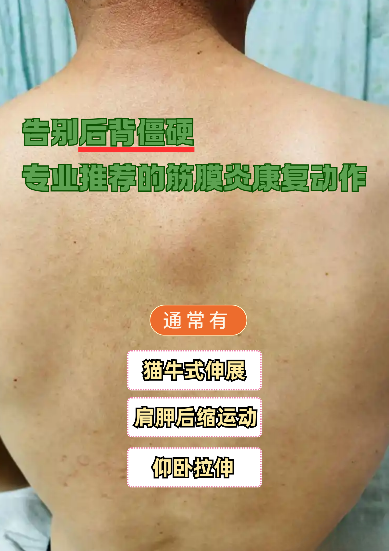 背部筋膜炎的症状及治疗