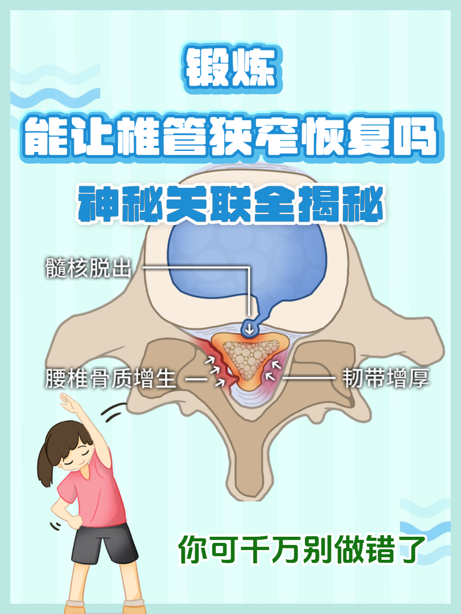 椎管狭窄的最佳治疗方法