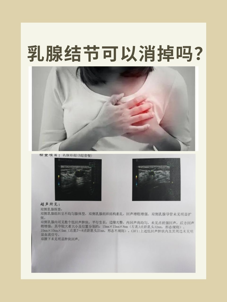 乳腺结节严重吗