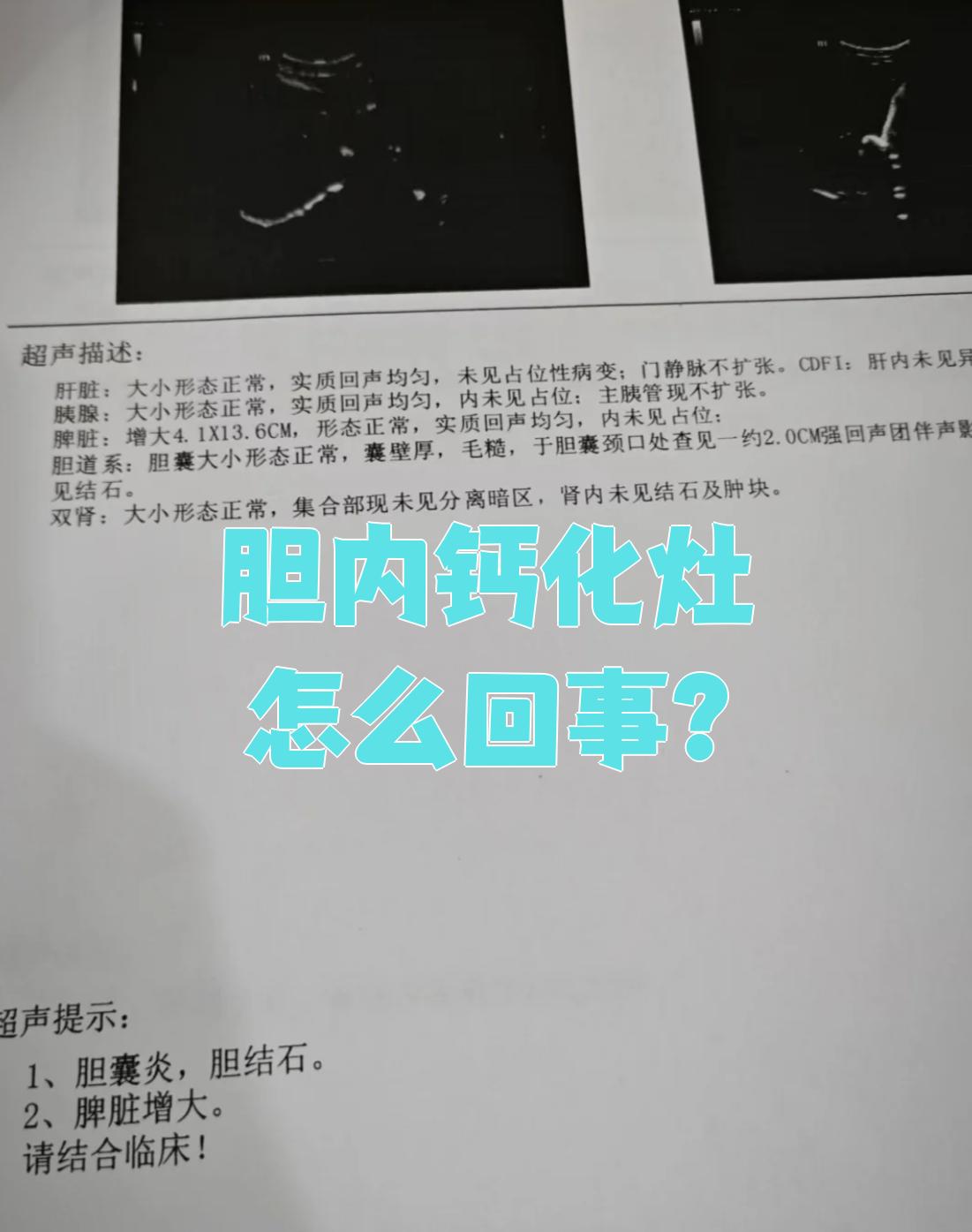 为什么会有肝脏钙化灶