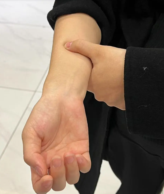 手腕扭到筋了,不能动,一动就疼