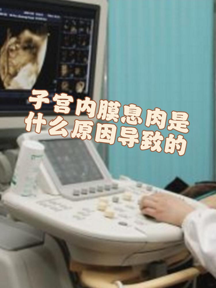 子宫内膜息肉的症状表现有哪些