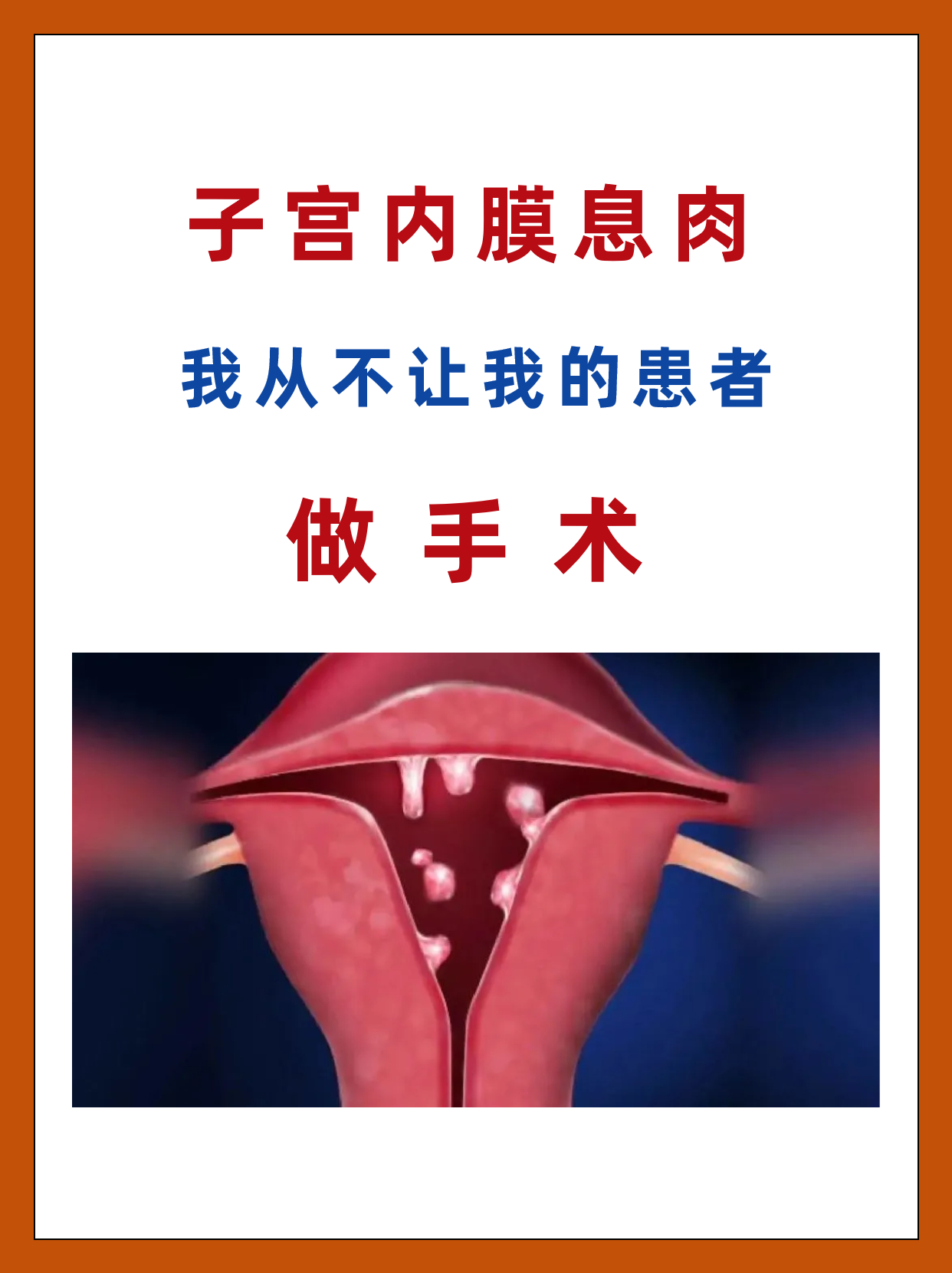 子宫息肉会很严重吗