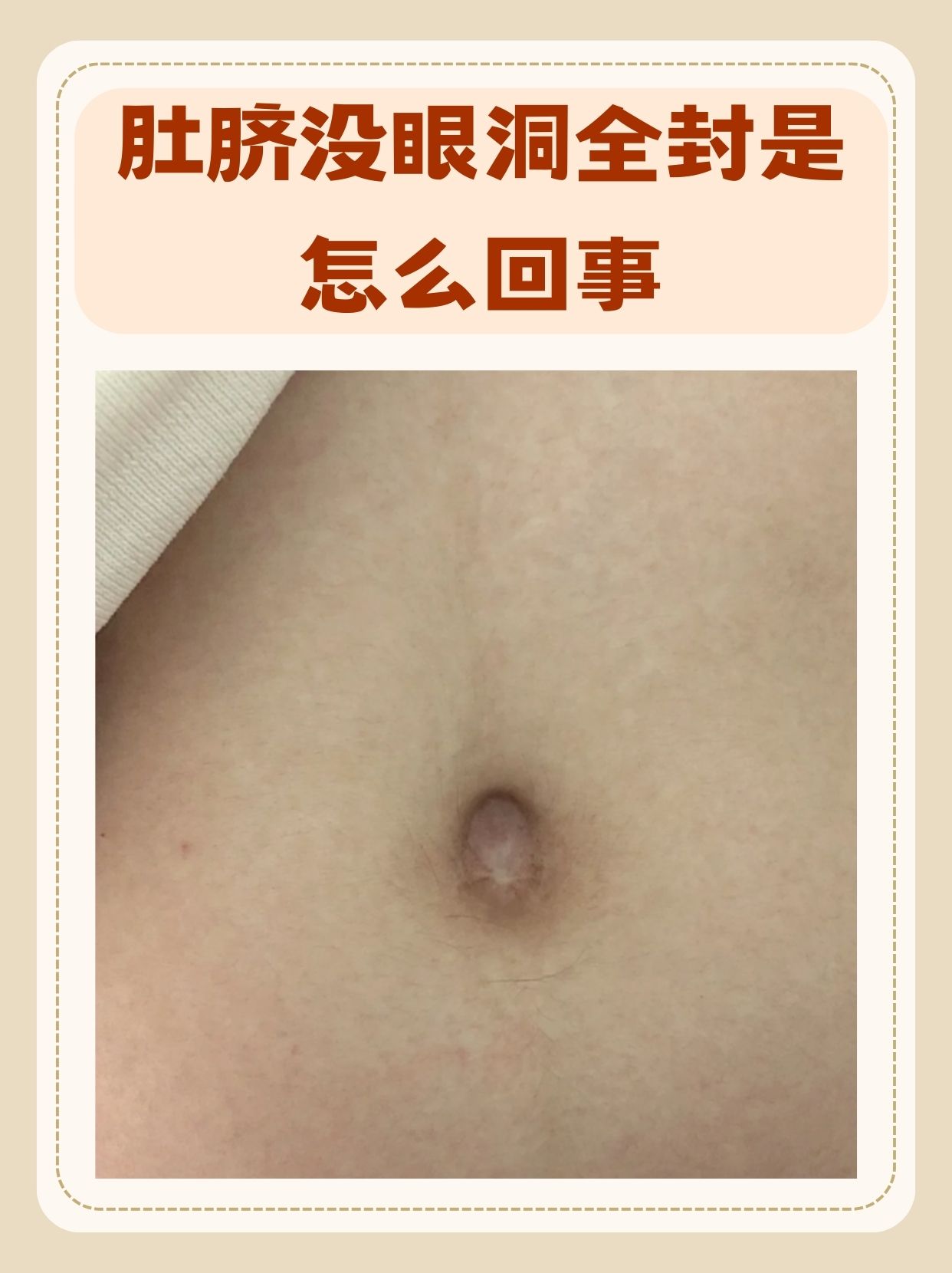 肚脐眼发臭有没有关系