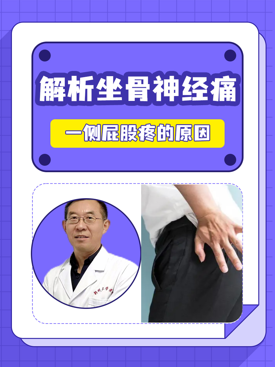 屁股痛,是坐骨神经痛吗