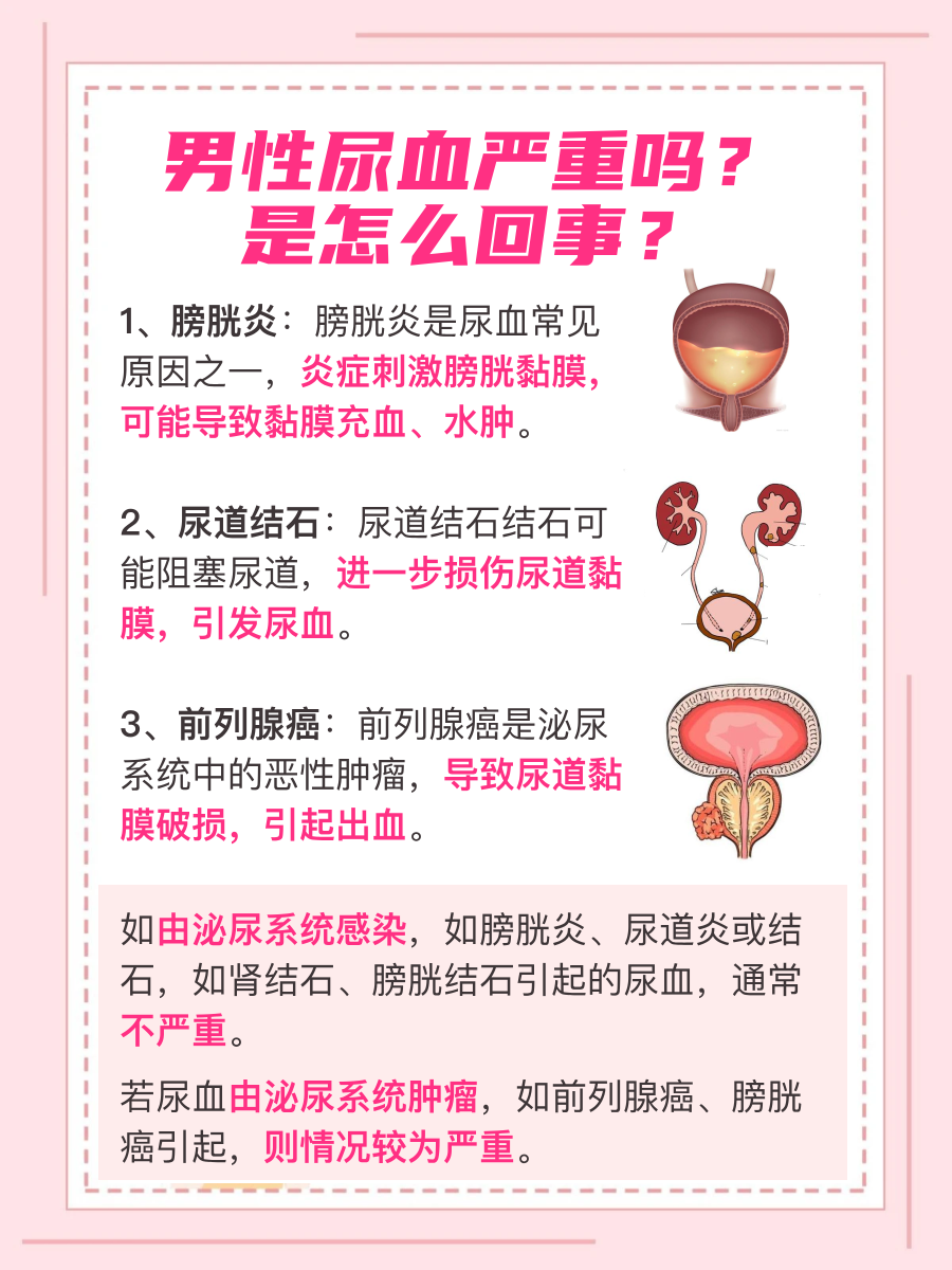 小便时,尿里有血块是怎么回事.
