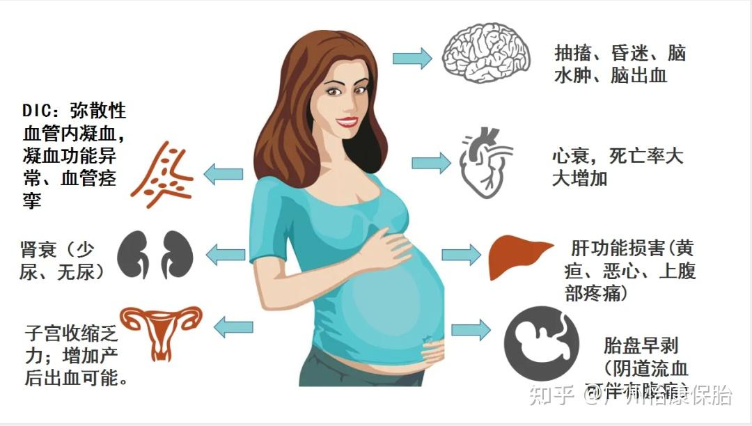 妊娠期高血压对胎儿的影响