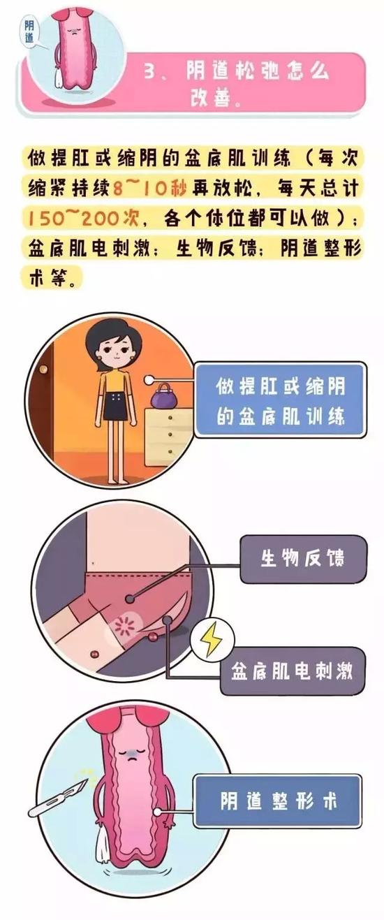 生完孩子阴道松弛怎么办?